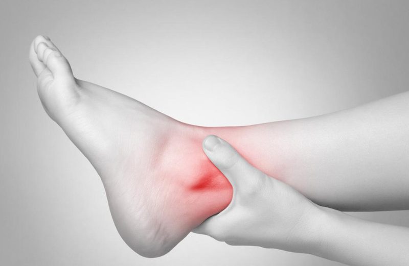Cara Menyembuhkan Kaki Terkilir atau Keseleo yang Efektif